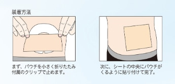 装着方法